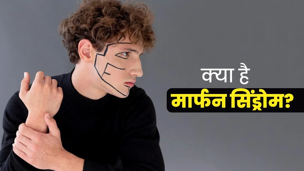 मार्फन स‍िंड्रोम से ब‍िगड़ता है हड्ड‍ी, आंख और हार्ट की सेहत, जानें इस दुर्लभ बीमारी के लक्षण, कारण और इलाज