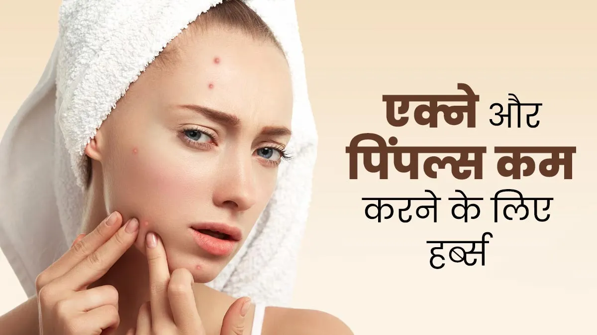 एक्ने और पिंपल्स कम करने के लिए इस्तेमाल करें ये 5 हर्ब्स, जल्द दिखेगा असर