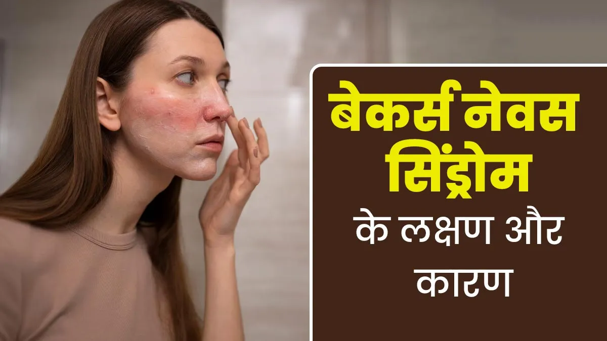 त्वचा और मांसपेशियों को प्रभावित कर सकता है बेकर्स नेवस सिंड्रोम, जानें इसके लक्षण और कारण