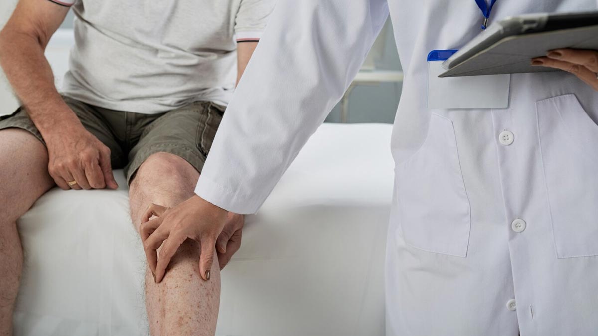 how-to-treat-osteoarthritis-i