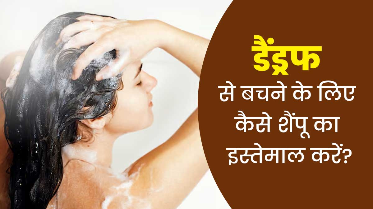 बार-बार क्यों हो जाता है डैंड्रफ? जानें किस तरह का शैंपू इस्तेमाल करना होता है फायदेमंद