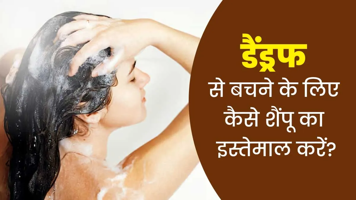 बार-बार क्यों हो जाता है डैंड्रफ? जानें किस तरह का शैंपू इस्तेमाल करना होता है फायदेमंद