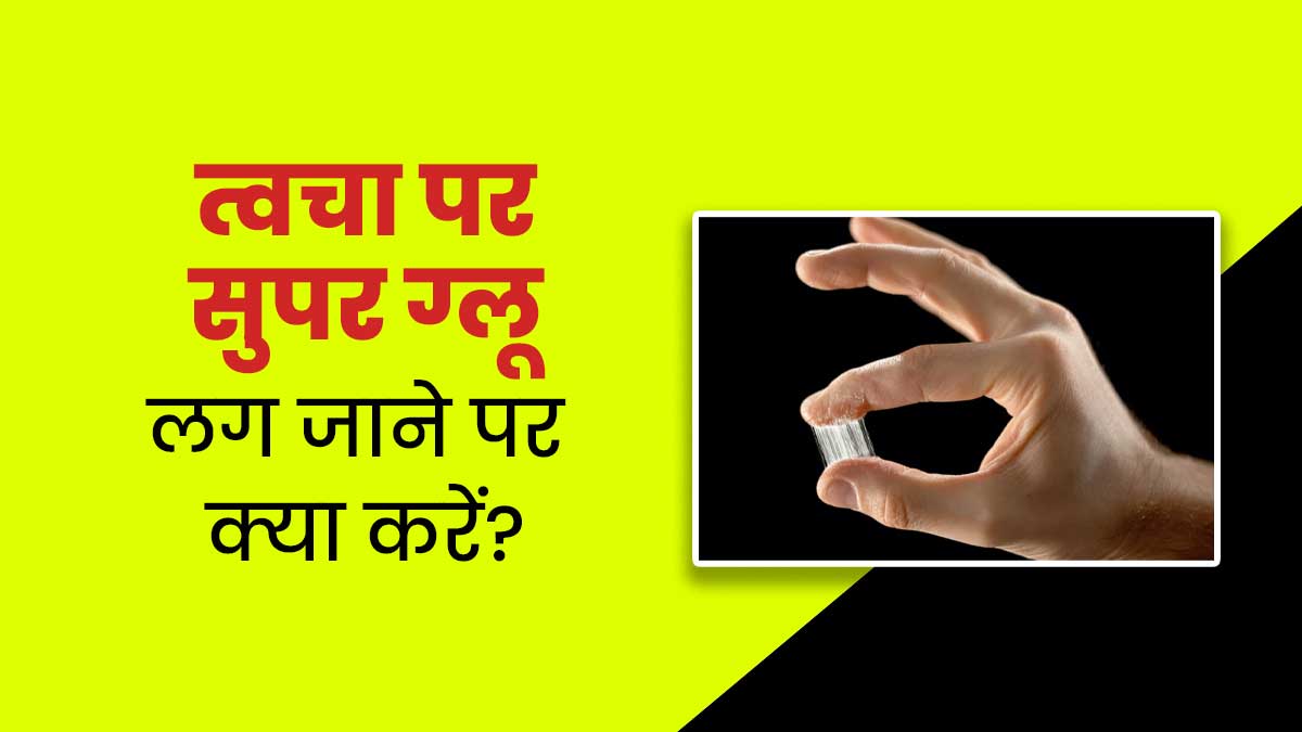 त्वचा पर सुपर ग्लू लग जाने पर क्या करें? डॉक्‍टर से जानें इसके नुकसान और ग्‍लू को हटाने के सुरक्षित उपाय