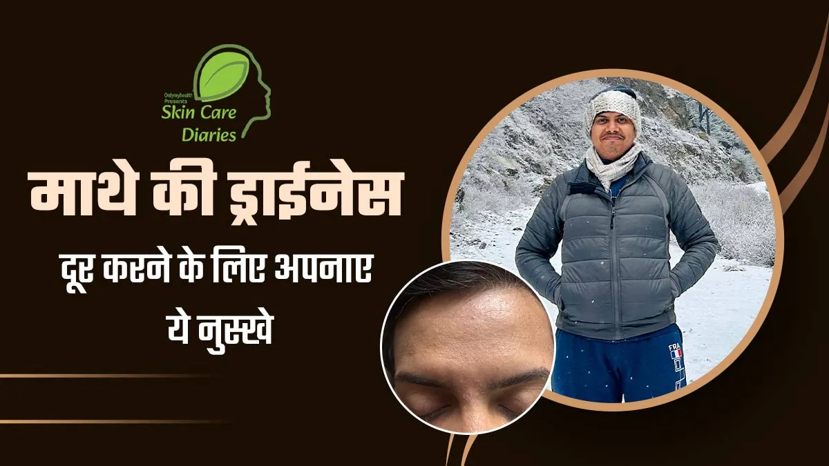 विंटर ट्रैकिंग के बाद नीलाभ के माथे की त्वचा हो गई थी बेहद ड्राई, जानें किन घरेलू नुस्खों को आजमाकर मिली राहत