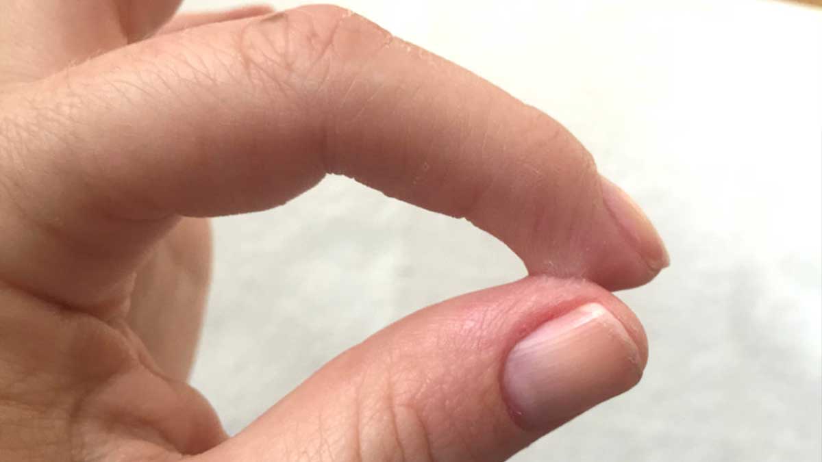 how-to-remove-super-glue-safely-from-skin