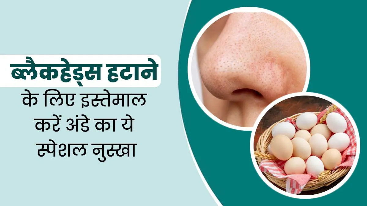 ब्लैकहेड्स हटाने के लिए इस्तेमाल करें अंडे का ये खास नुस्खा, बढ़ेगी चेहरे की चमक और खूबसूरती