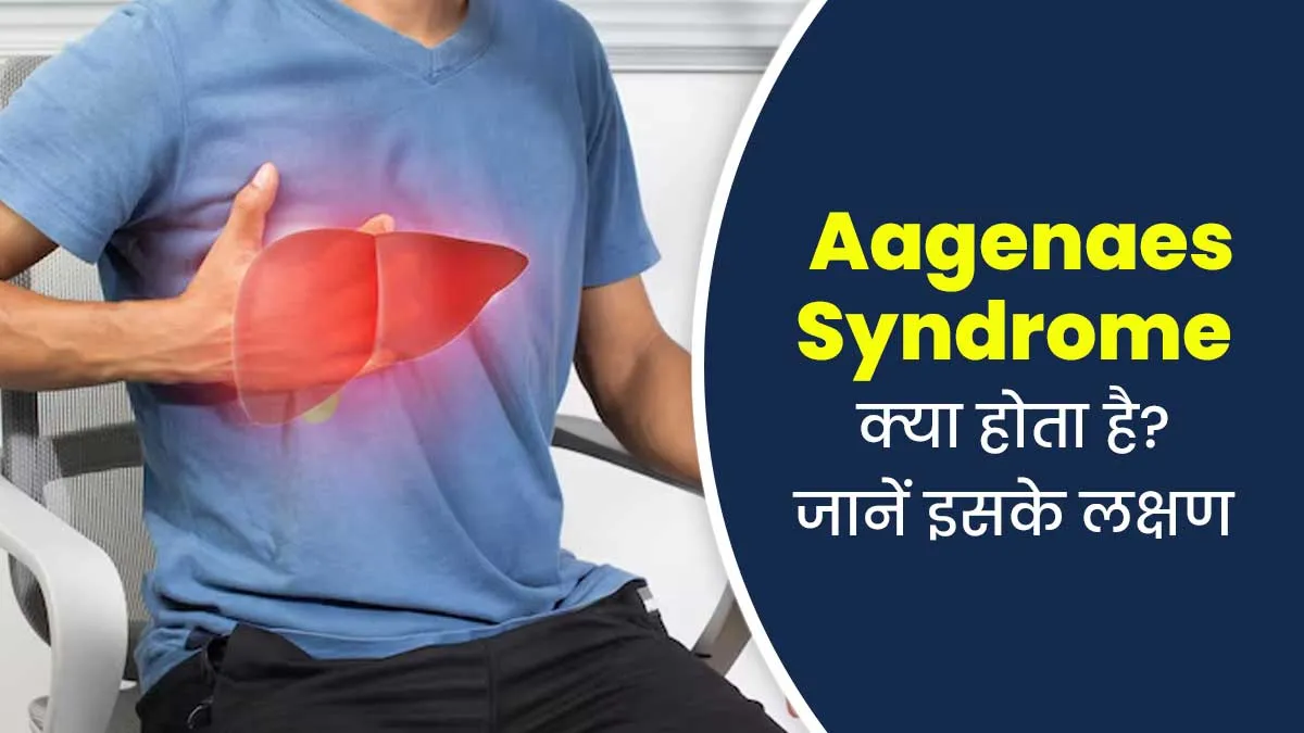 लिवर को प्रभावित कर सकता है एगेनीस सिंड्रोम, डॉक्टर से जानें इसके लक्षण