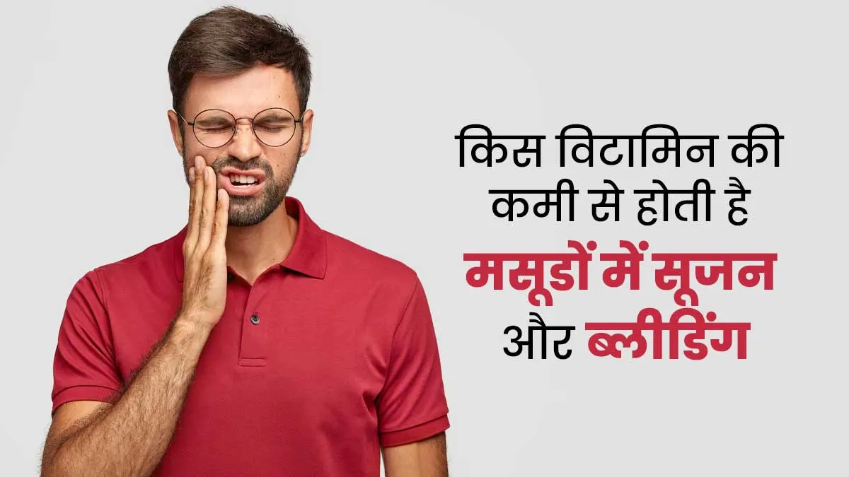 शरीर में किस विटामिन की कमी से होती है मसूडों में सूजन और ब्लीडिंग, डॉक्टर से जानें