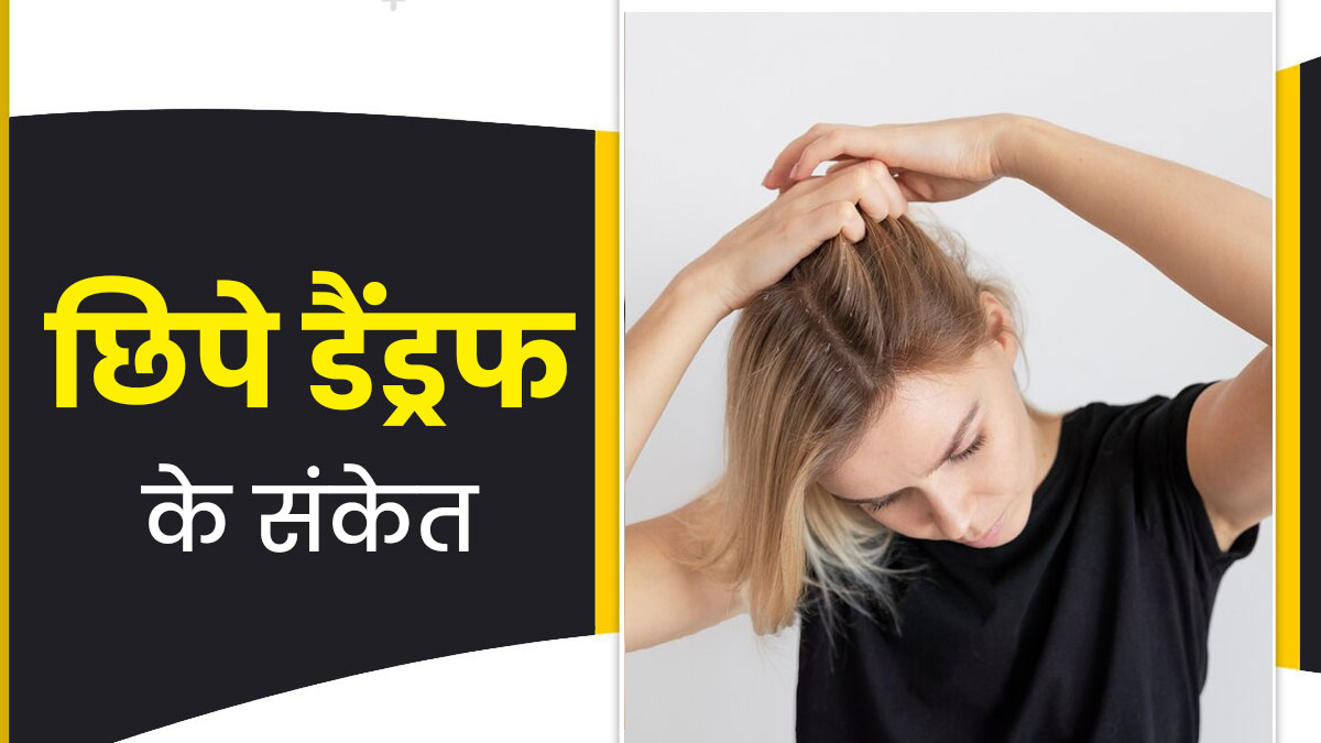स्किन पर दिखने वाले इन 6 संकेतों को न करें नजरअंदाज, स्कैल्प में छिपे डैंड्रफ के हो सकते हैं लक्षण
