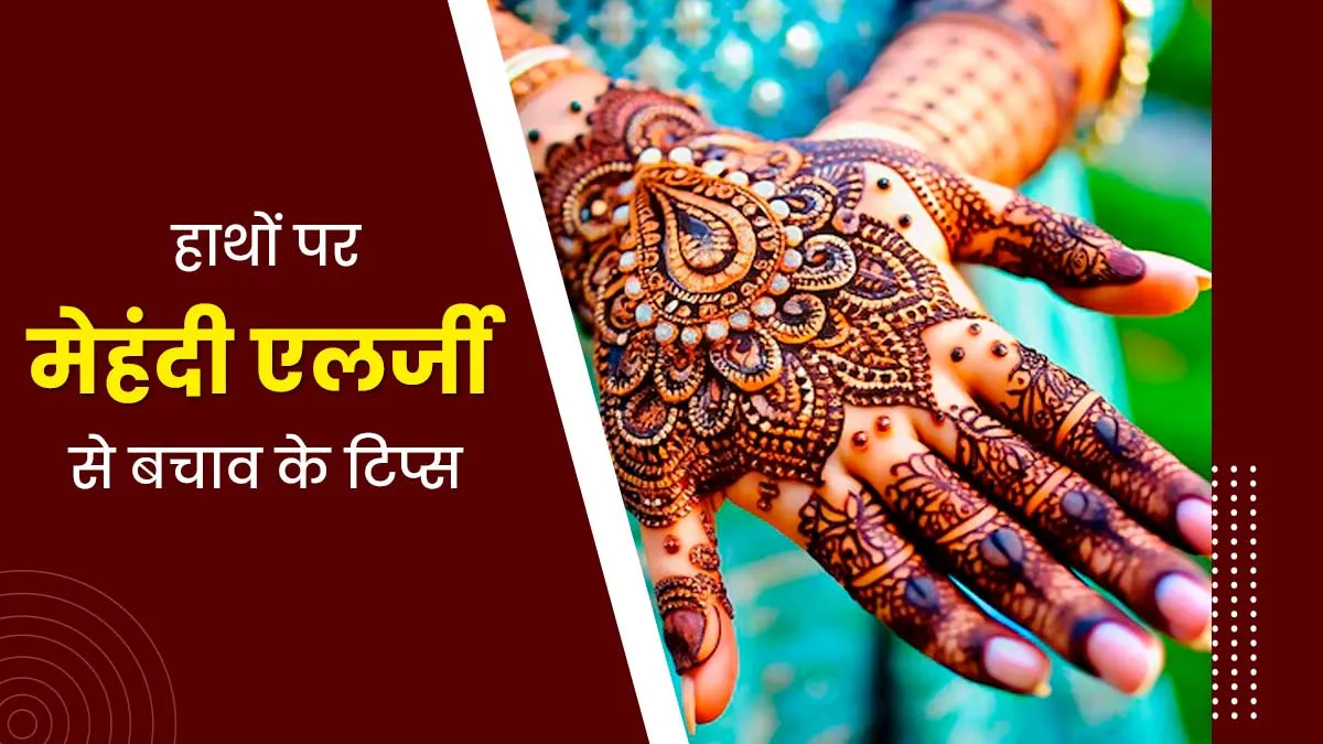 मेहंदी लगाने के बाद हाथों में हो जाती है एलर्जी तो अपनाएं ये 5 टिप्स, जलन और खुजली से मिलेगी राहत