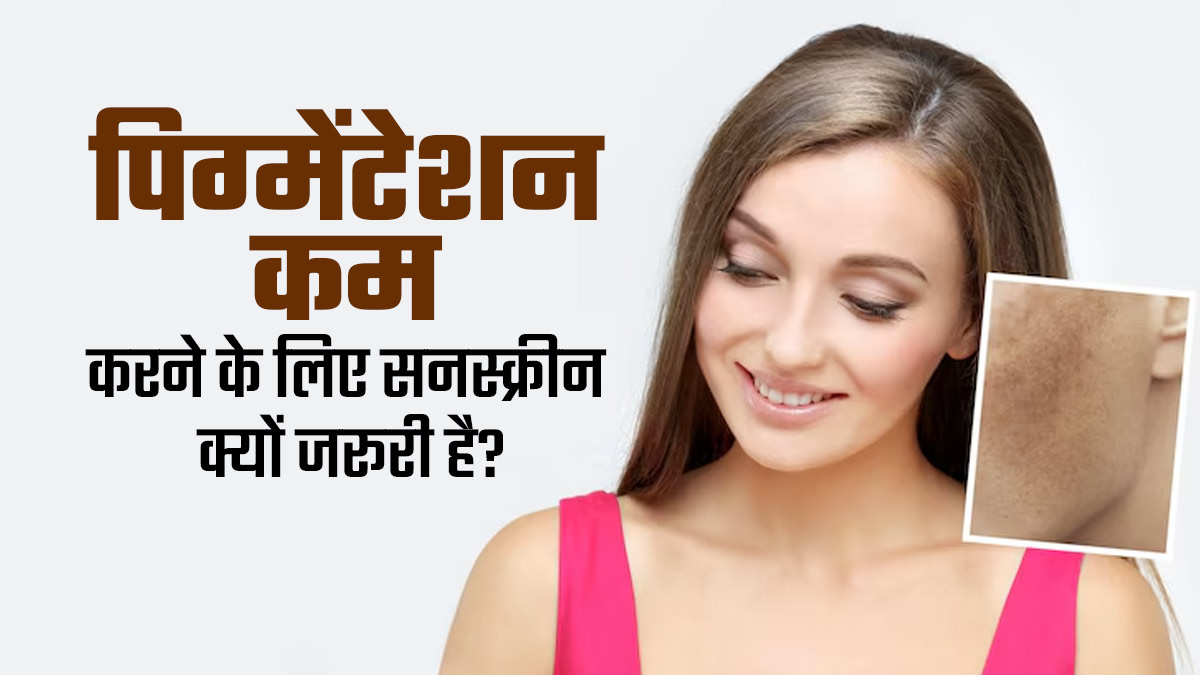 पिग्मेंटेशन कम करने के लिए सनस्क्रीन लगाना क्यों जरूरी है? डॉक्टर से जानें