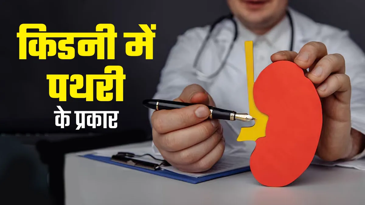 इन 4 तरह से किडनी में हो सकती है पथरी की समस्या, डॉक्टर से जानें कैसे करें पहचान