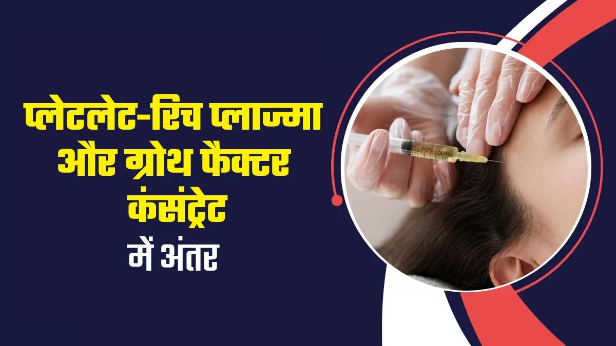 PRP और GFC, नए बाल उगाने और गंजापन दूर करने की दोनों तकनीक में क्या अंतर है? डॉक्टर से जानें