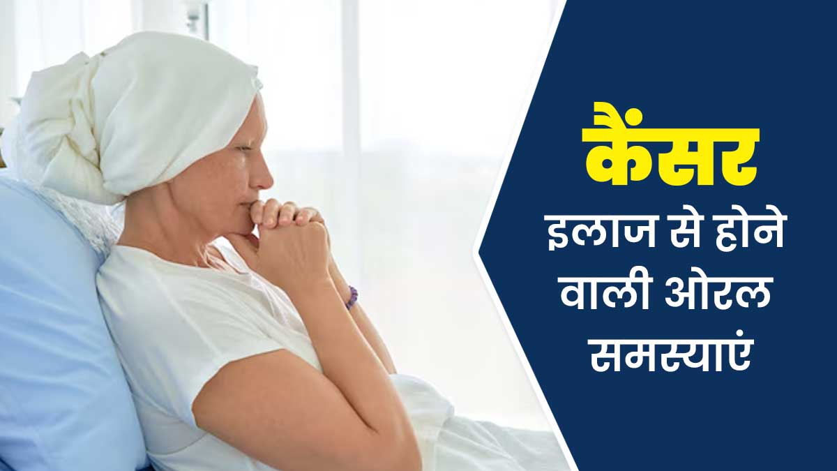 कैंसर के इलाज में अक्सर होती हैं ओरल हेल्‍थ से जुड़ी ये 7 समस्‍याएं, जानें इसे कंट्रोल करने के उपाय