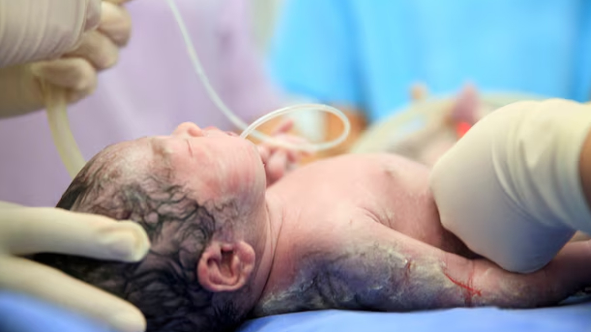 possible causes of stillbirth 1