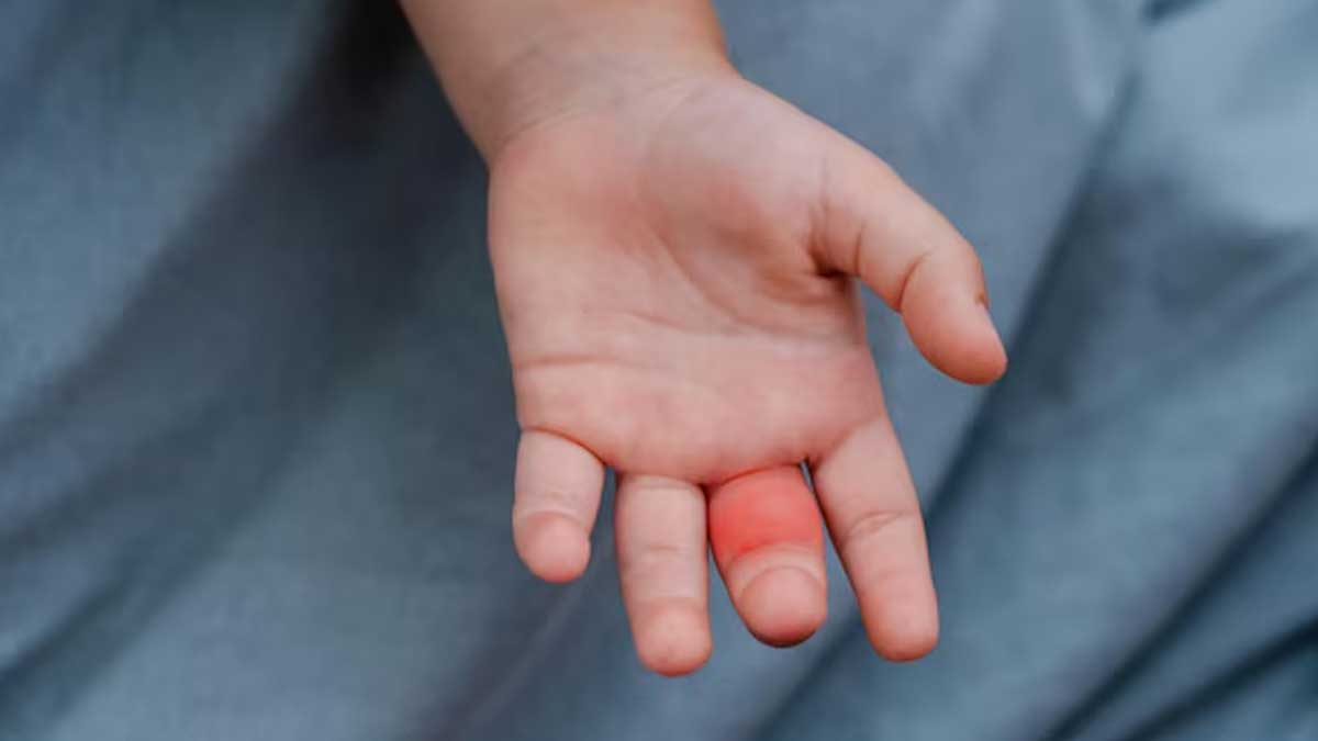 what causes swollen fingers in kids in hindi 01
