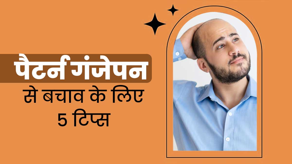 पुरुष गंजेपन से बचाव के लिए अपनाएं ये 5 आयुर्वेदिक टिप्स