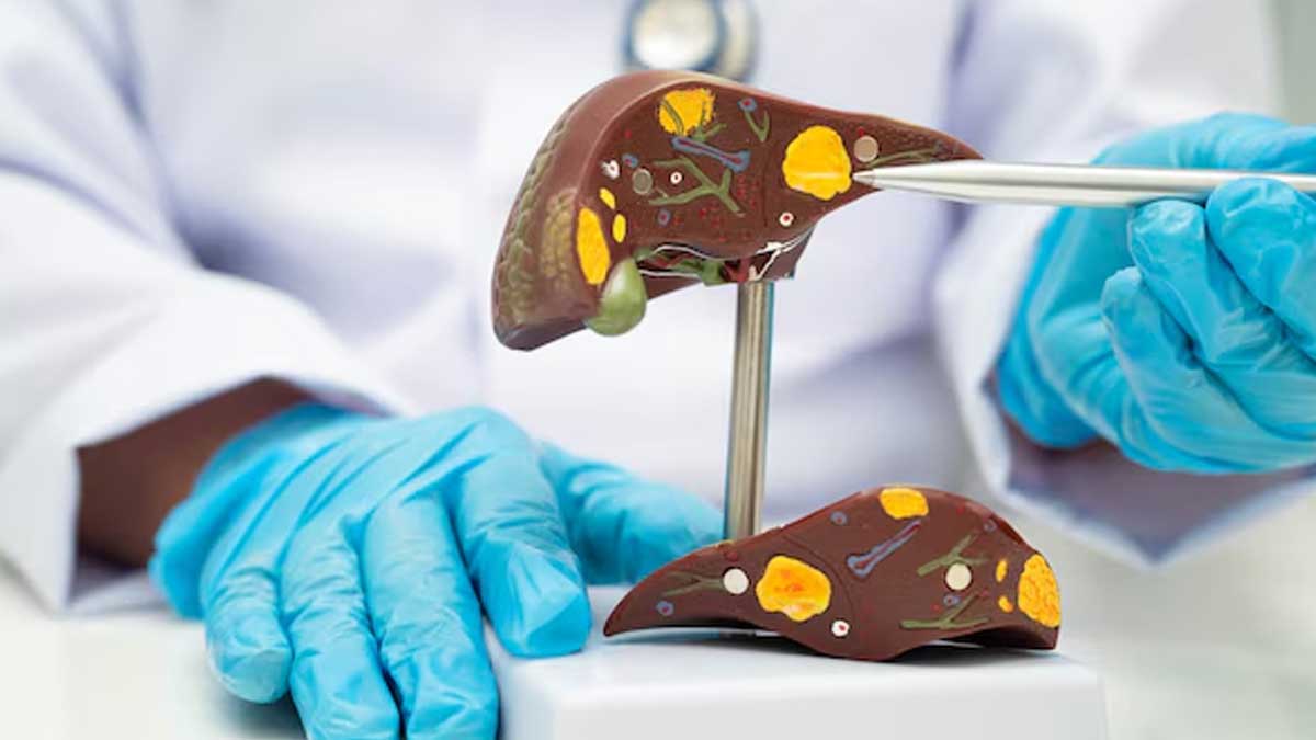 Stages Of Liver Damage In Hindi stages-of-liver-problems-in