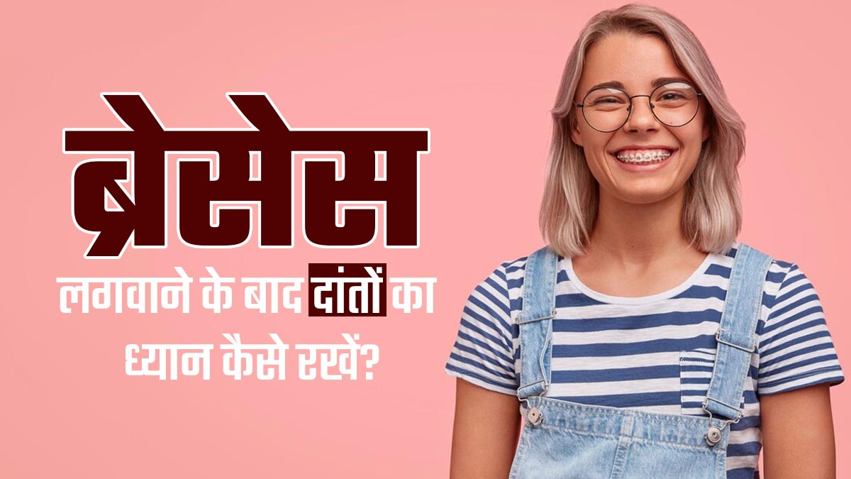 दांतों में ब्रेसेस लगवाने के बाद देखभाल कैसे करें? डॉक्टर से जानें