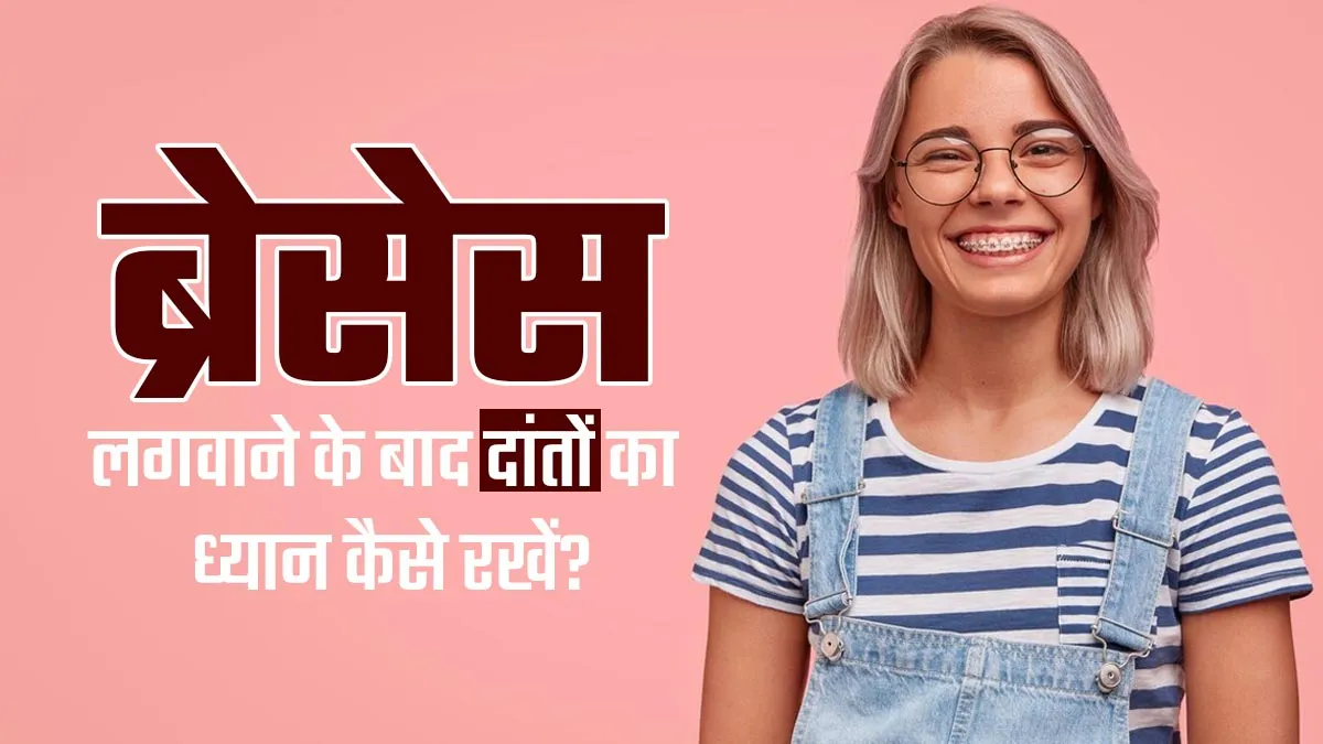 दांतों में ब्रेसेस लगवाने के बाद देखभाल कैसे करें? डॉक्टर से जानें
