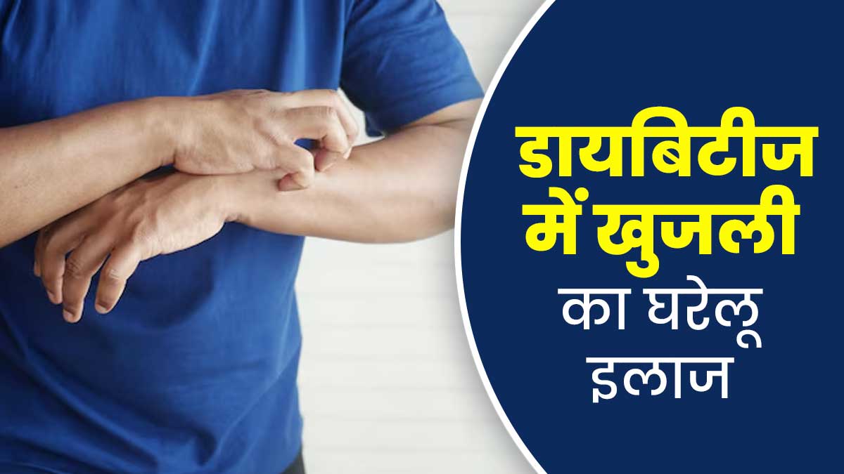 डायबिटीज के कारण त्‍वचा में हो रही है खुजली? राहत के ल‍िए अपनाएं ये 7 घरेलू उपाय