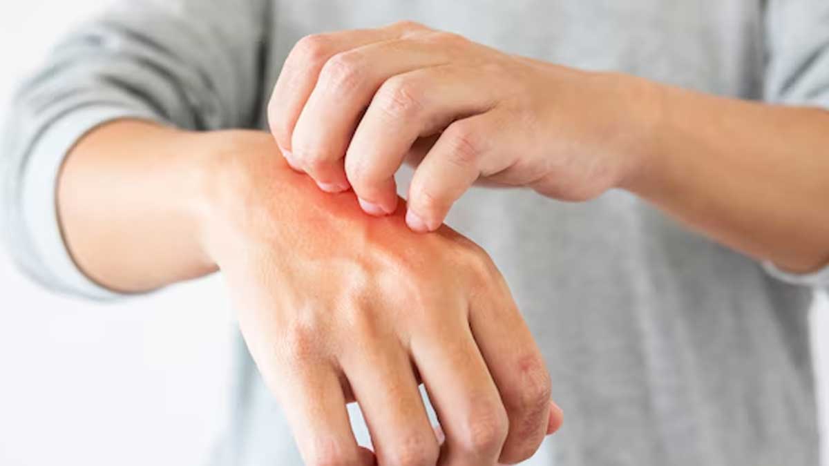 itching-in-diabetes