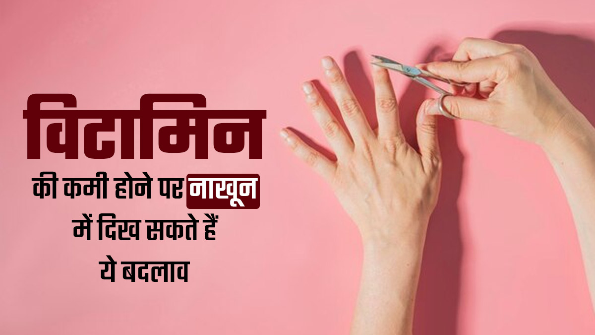 शरीर में विटामिन्स की कमी होने पर नाखूनों में साफ दिखते हैं ये 5 संकेत, डॉक्टर से जानें कैसे पहचानें
