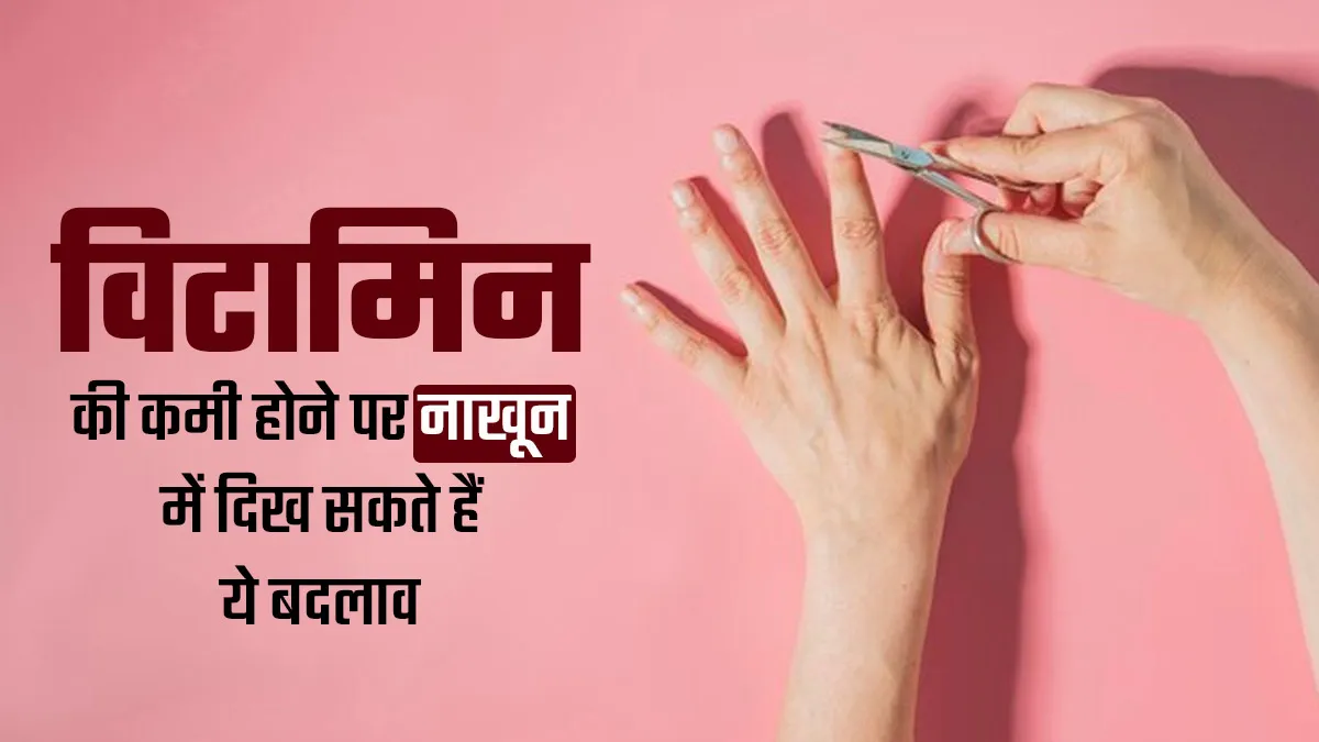 शरीर में विटामिन्स की कमी होने पर नाखूनों में साफ दिखते हैं ये 5 संकेत, डॉक्टर से जानें कैसे पहचानें
