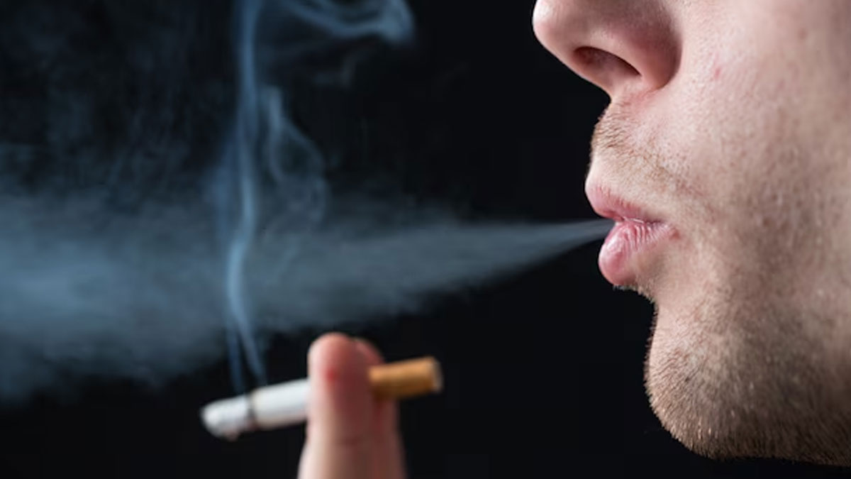 does smoking cause vitiligo 01