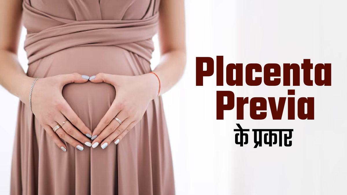 प्लेसेंटा प्रीविया के हैं कई प्रकार, डॉक्टर से जानें इनके बारे में विस्तार से