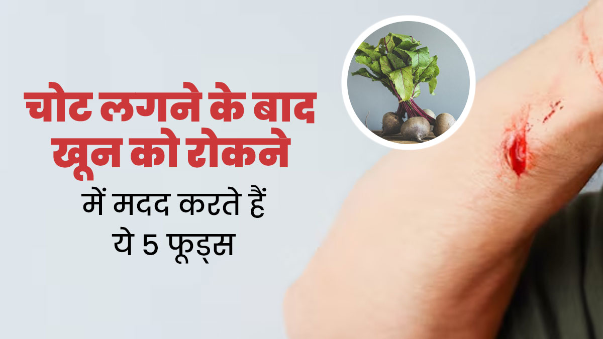 चोट लगने पर खून बहना जल्दी बंद होना है जरूरी, जानें 5 फूड्स जो ब्लड क्लॉट तेजी से बनाने में करते हैं मदद