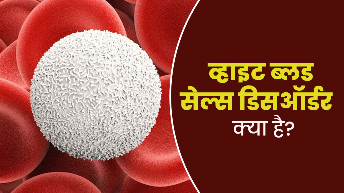 व्हाइट ब्लड सेल्स ड‍िसऑर्डर (असामान्‍यता) क्‍या है? डॉक्‍टर से जानें इसके लक्षण, कारण और इलाज