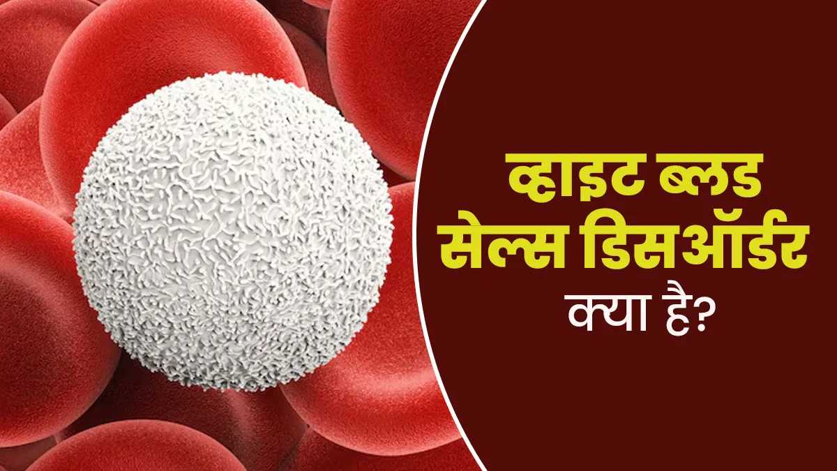 व्हाइट ब्लड सेल्स ड‍िसऑर्डर (असामान्‍यता) क्‍या है? डॉक्‍टर से जानें इसके लक्षण, कारण और इलाज