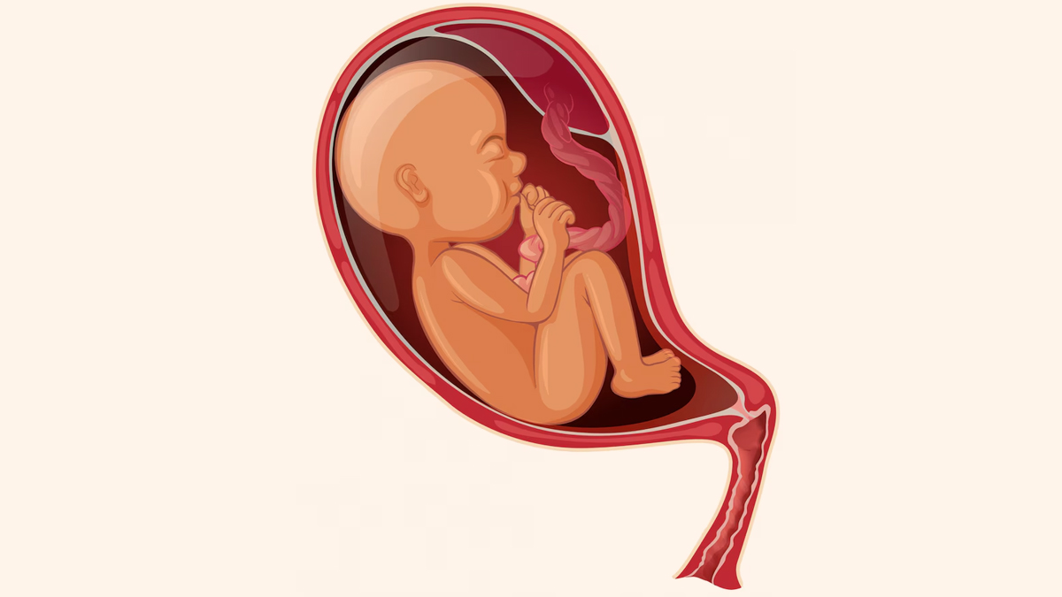 What Are The Different Types Of Placenta Previa 1