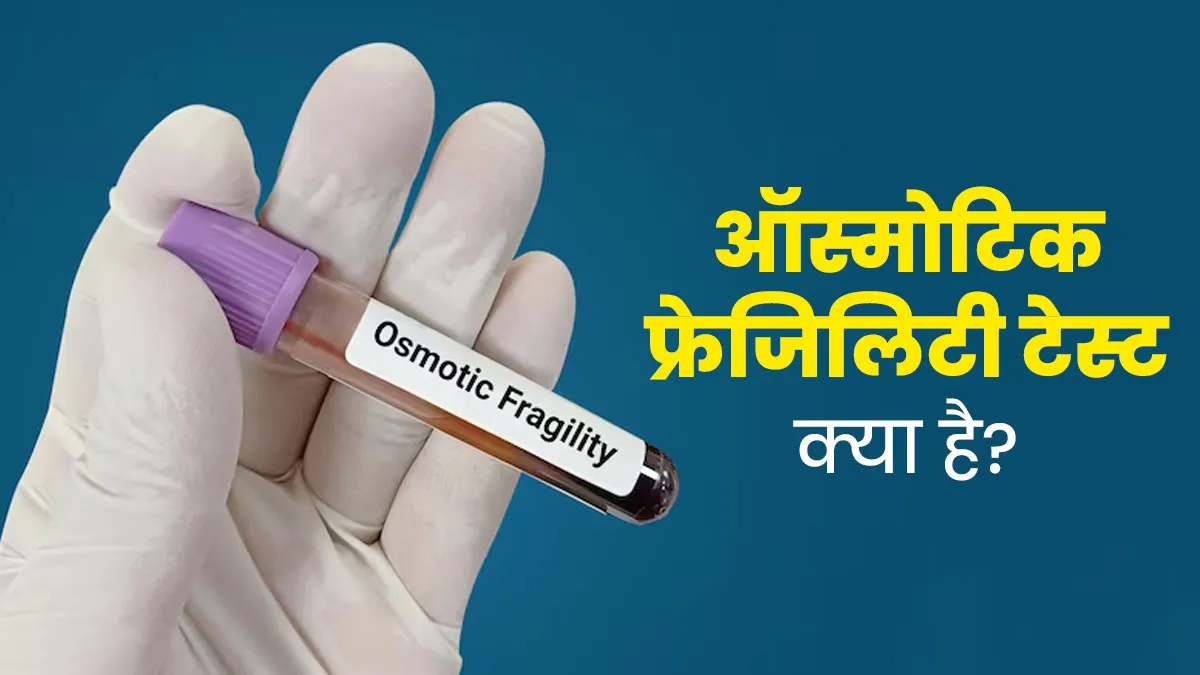 ऑस्मोटिक फ्रेजिलिटी टेस्ट क्या है? डॉक्‍टर से जानें कब पड़ती है इसे करवाने की जरूरत