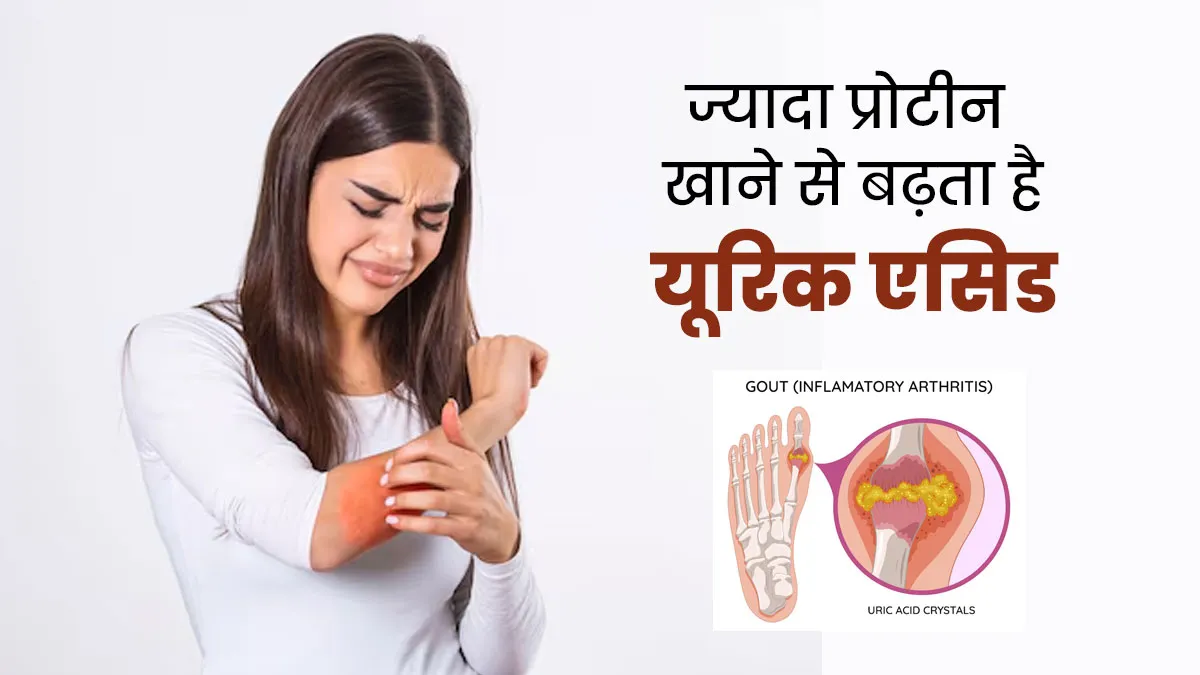 प्रोटीन के ज्यादा मात्रा में सेवन से बढ़ता है यूरिक एसिड? जानें एक्सपर्ट से