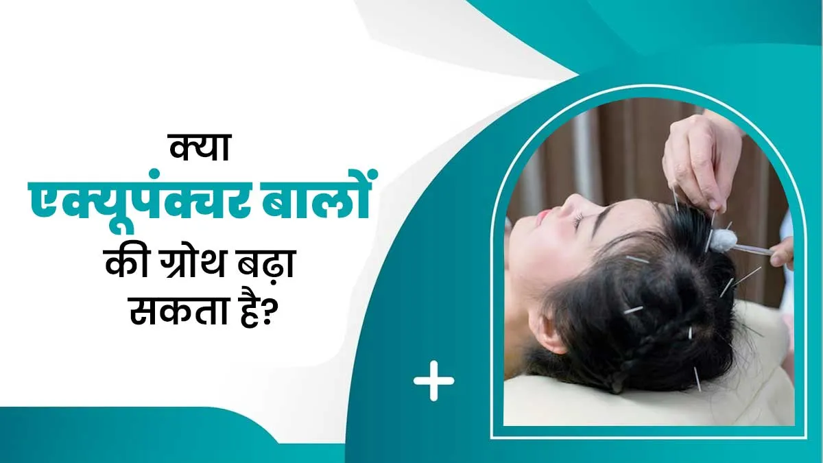 बालों की ग्रोथ के लिए कितना असरदार है एक्यूपंक्चर? जानें एक्सपर्ट की राय