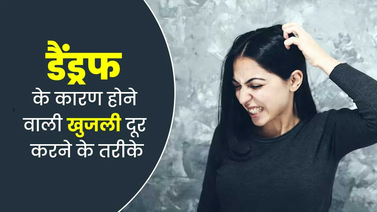 डैंड्रफ के कारण सिर में बहुत ज्यादा खुजली हो तो क्या करें? जानें एक्सपर्ट की सलाह