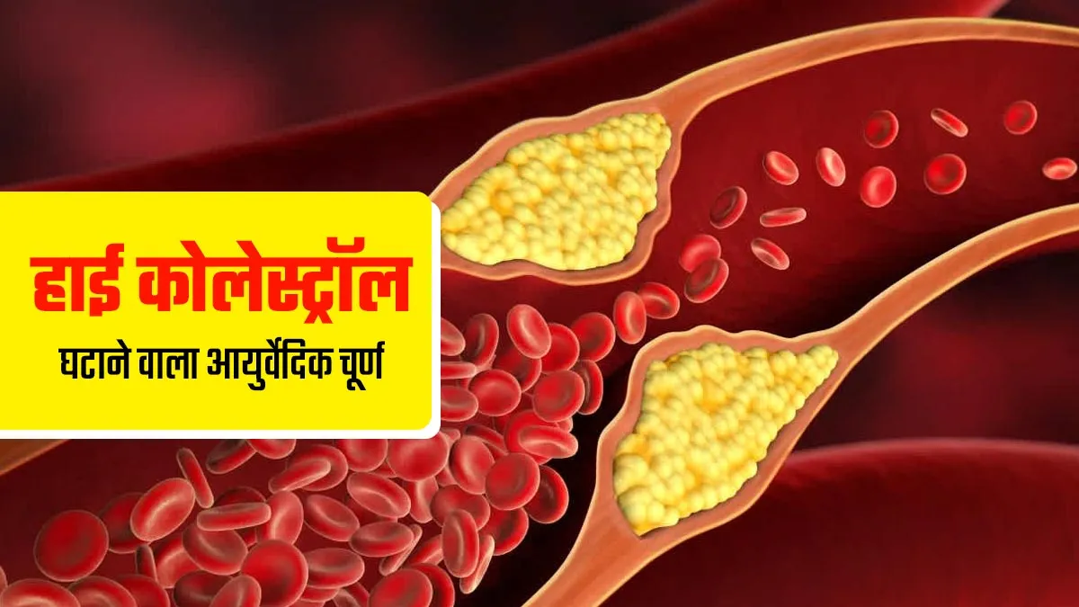 हाई कोलेस्ट्रॉल को कम करने में मदद करेगा ये आयुर्वेदिक चूर्ण, एक्सपर्ट से जाने रेसिपी और फायदे