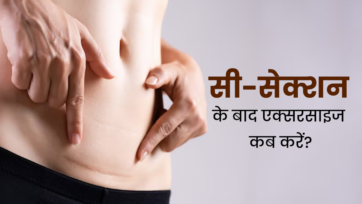 सी-सेक्शन डिलीवरी के कितने समय बाद एक्सरसाइज शुरू कर सकते हैं? डॉक्टर से जानें