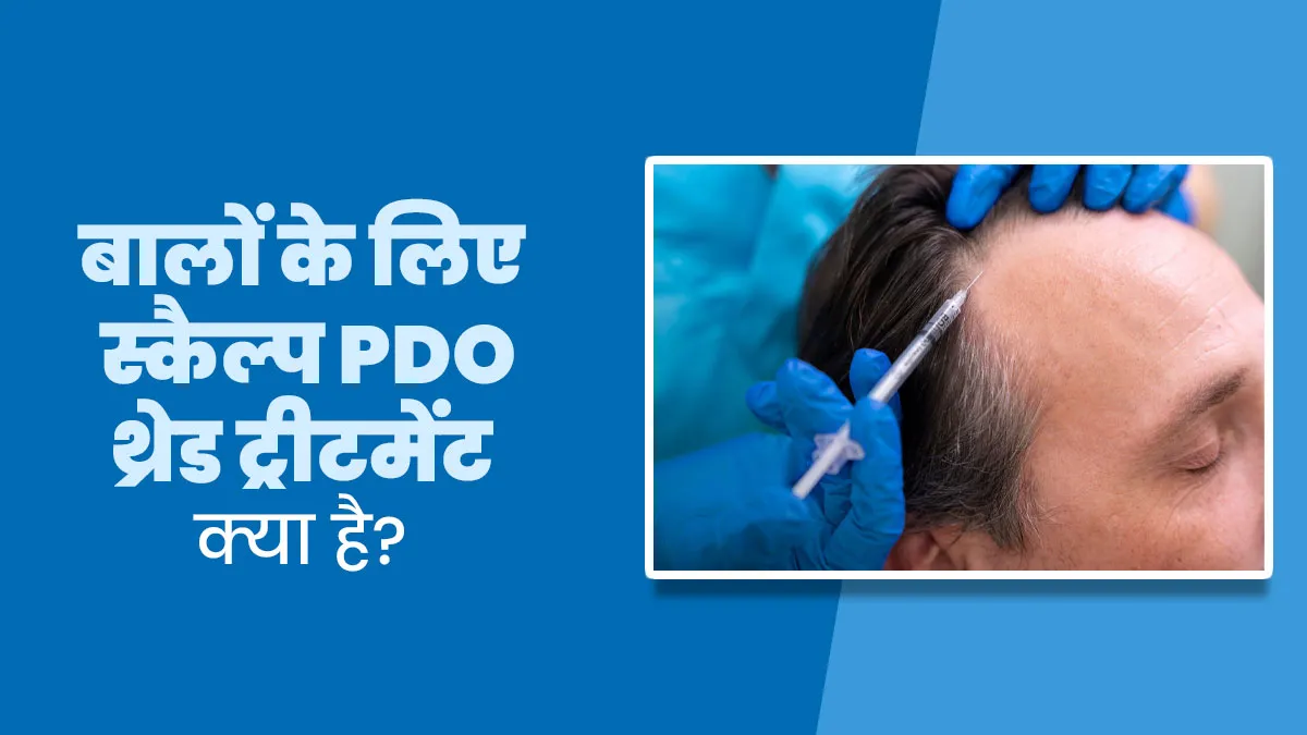 क्या स्कैल्प PDO थ्रेड से बाल फिर से घने हो सकते हैं? जानें यह ट्रीटमेंट कैसे करता है काम