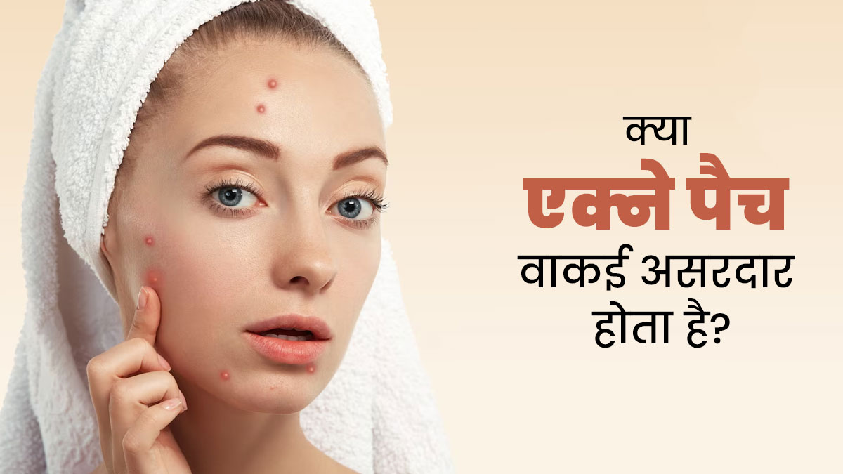 क्या एक्ने पैच वाकई असरदार होता है? जानें एक्सपर्ट की राय