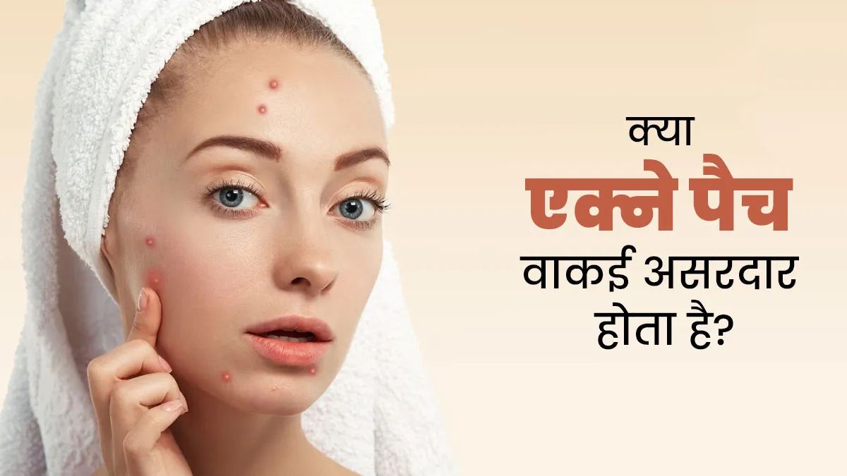 क्या एक्ने पैच वाकई असरदार होता है? जानें एक्सपर्ट की राय