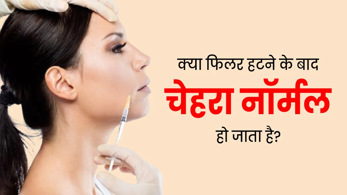 क्या फिलर हटने के बाद आपका चेहरा नॉर्मल हो जाता है? जानें क्या हो सकते हैं इसके नुकसान