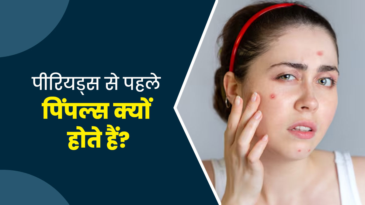 पीरियड्स से पहले क्यों होते हैं चेहरे पर दाने? जानें कारण और बचाव के तरीके
