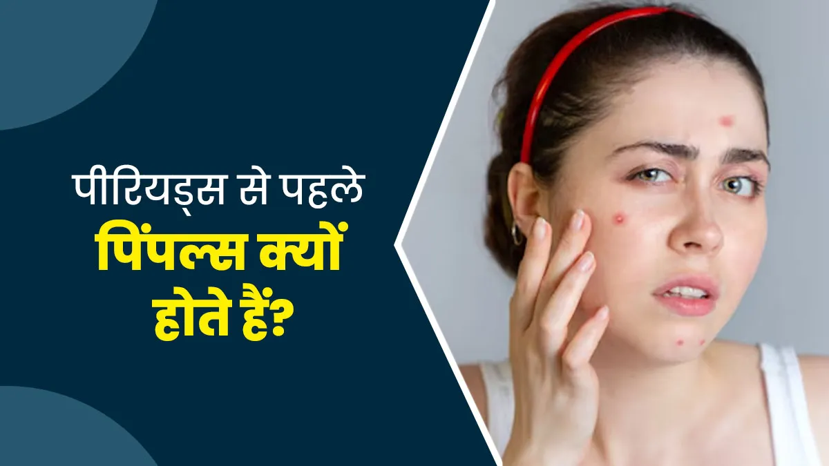 पीरियड्स से पहले क्यों होते हैं चेहरे पर दाने? जानें कारण और बचाव के तरीके