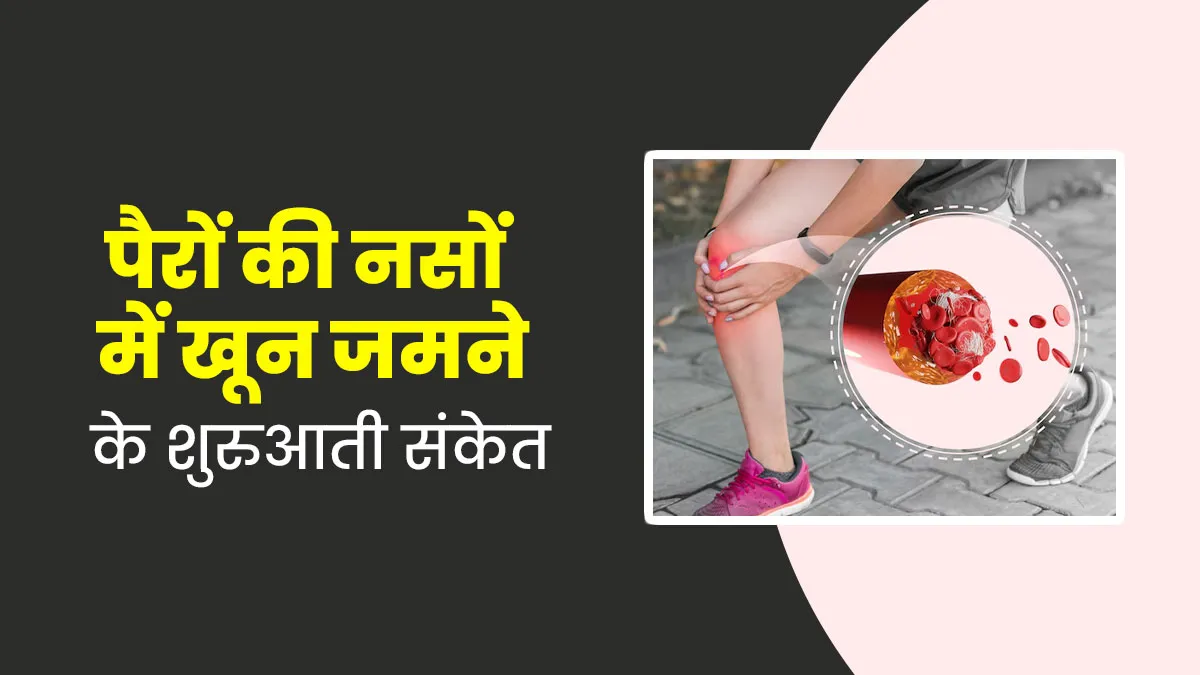 पैरों की नसों में खून जमने (Blood Clot) पर नजर आते हैं ये 5 शुरुआती संकेत, डॉक्टर से जानें इनके बारे में