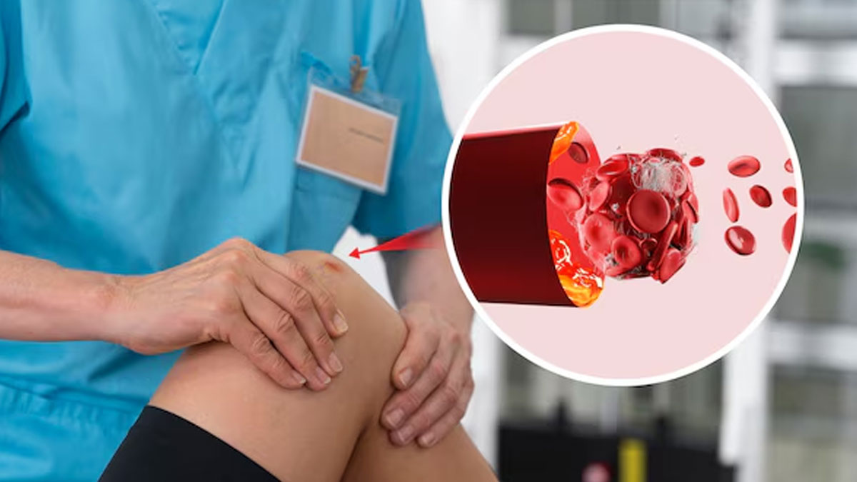 what are the first signs of a blood clot in the leg 01