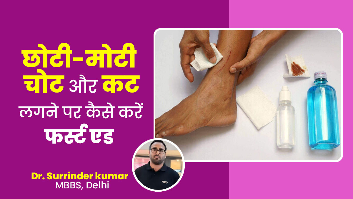 छोटी-मोटी चोट और कट लगने पर कैसे करें फर्स्ट एड? डॉक्टर से जानें