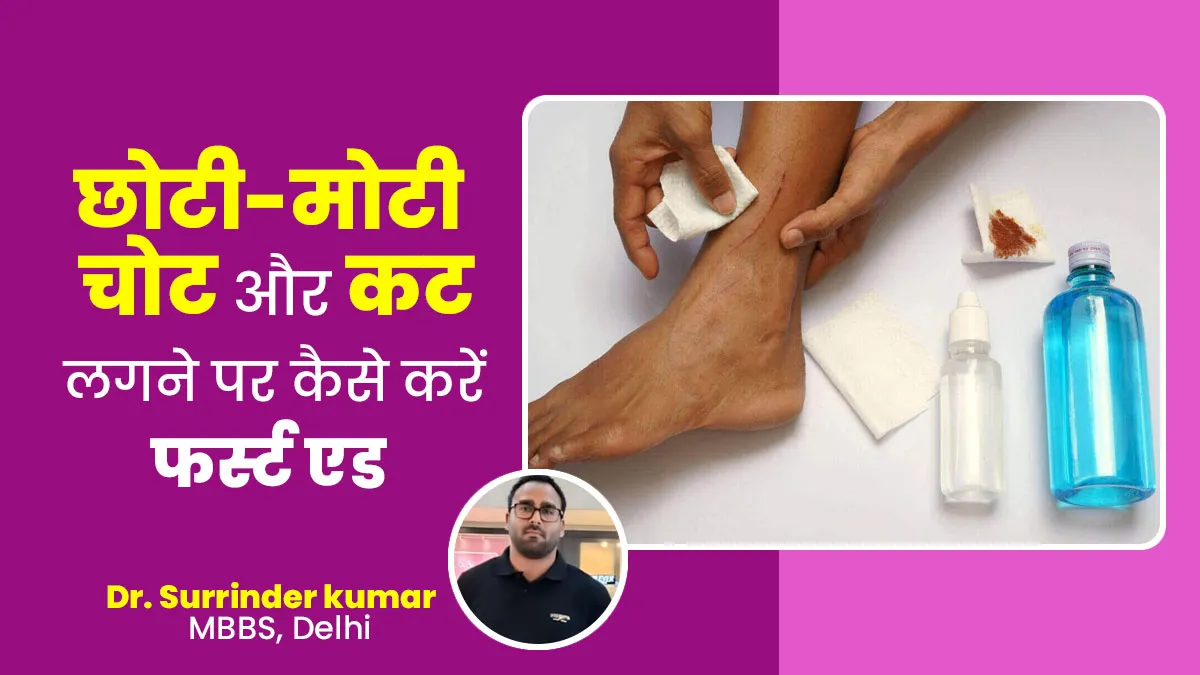 छोटी-मोटी चोट और कट लगने पर कैसे करें फर्स्ट एड? डॉक्टर से जानें